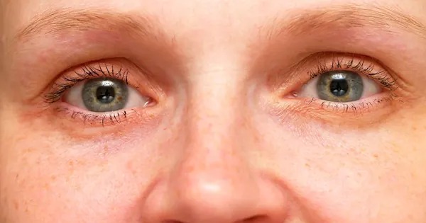 Ny studie: Sosiale bånd kan bremse aldringsprosessen